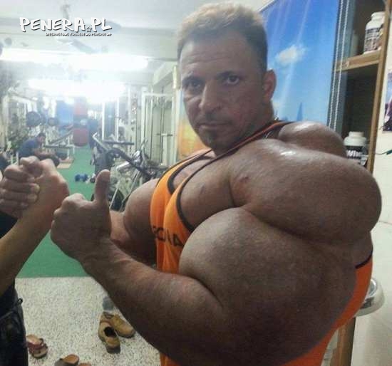 Człowiek synthol